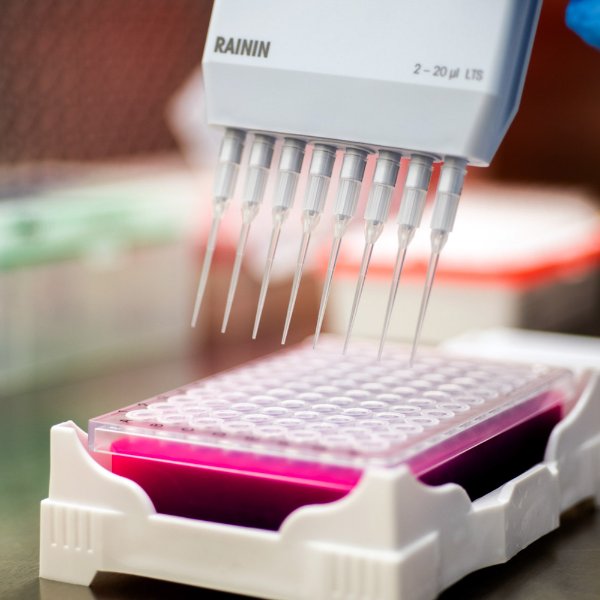 Wastewater testing equipment.