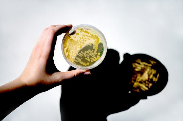 A hand holds a petri dish with a yellow substance in it. A shadow of the dish shows on a white surface.